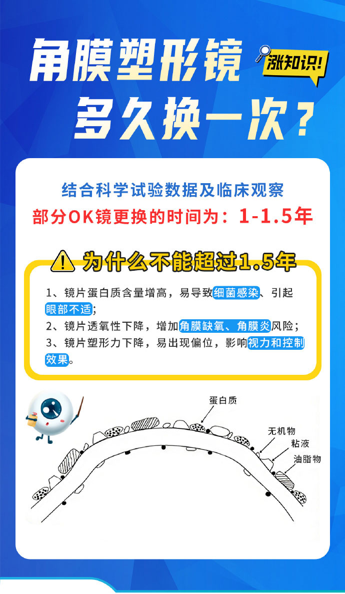 角膜塑形镜多久更换一次？